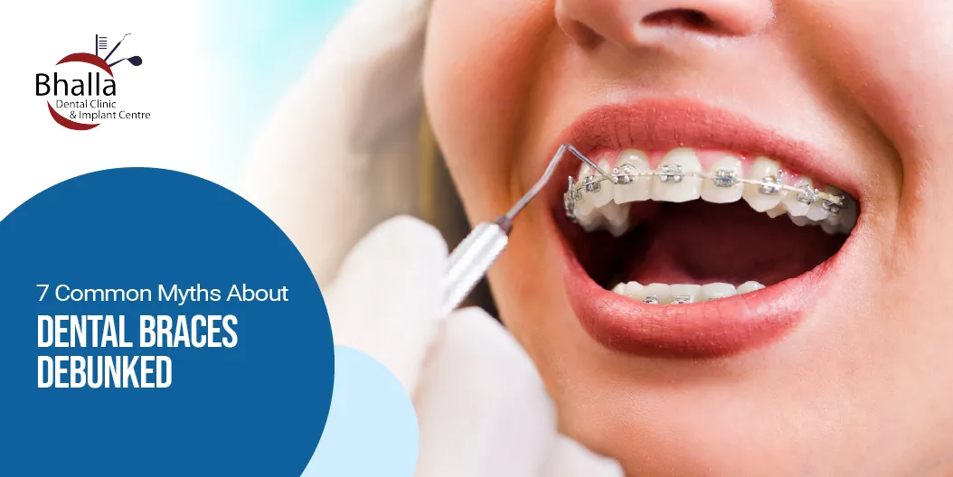 7 Common Myths About Dental Braces Debunked