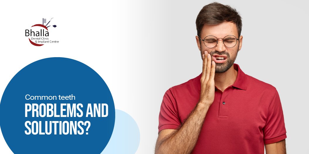 Common Teeth Problems and Solutions