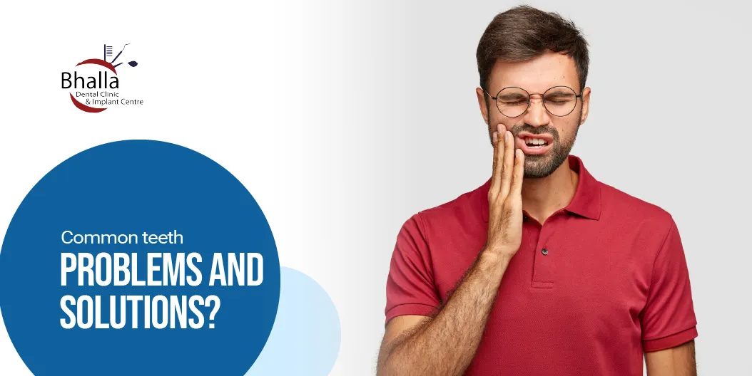 Common Teeth Problems and Solutions